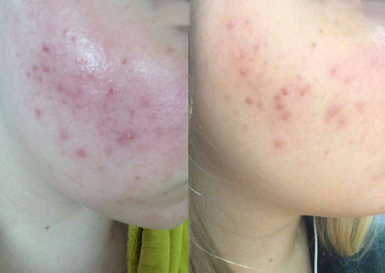 اسنس حلزون حجم ۱۰۰ میل اصل