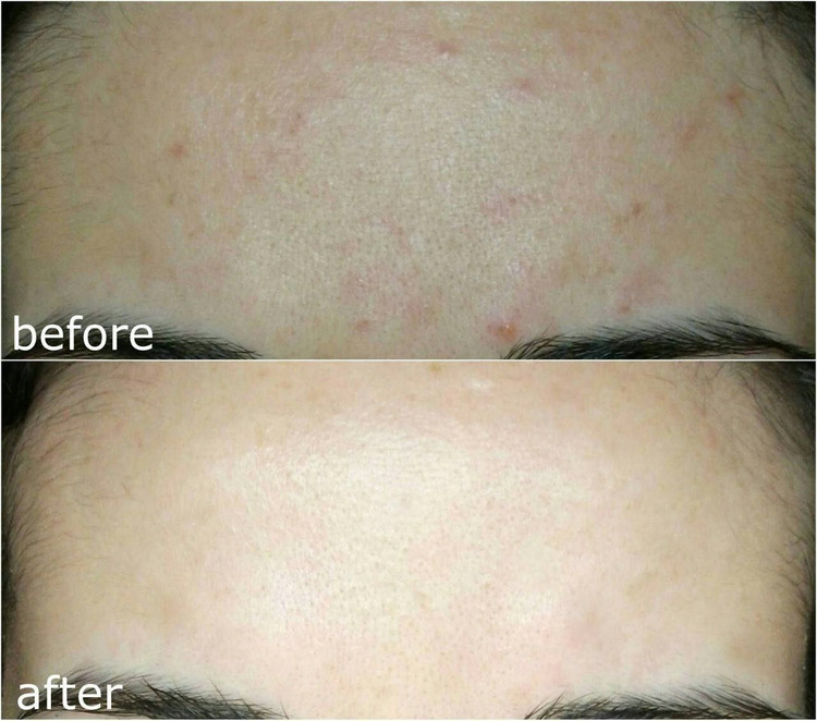 اسنس حلزون حجم ۱۰۰ میل اصل